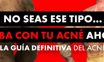 ACNÉ Y ESTEROIDES